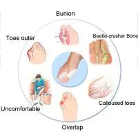 Bunion Corrector Silicone Toe Sleeves and Separator - Jays Shop uk