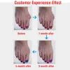 Bunion Corrector Silicone Toe Sleeves and Separator - Jays Shop uk