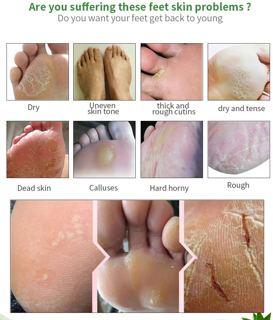 Moisturizing Foot Mask for Exfoliation and Care - Jays Shop uk