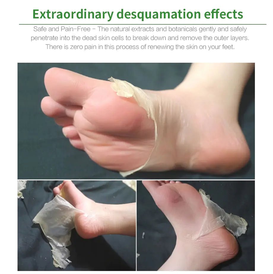 Moisturizing Foot Mask for Exfoliation and Care - Jays Shop uk